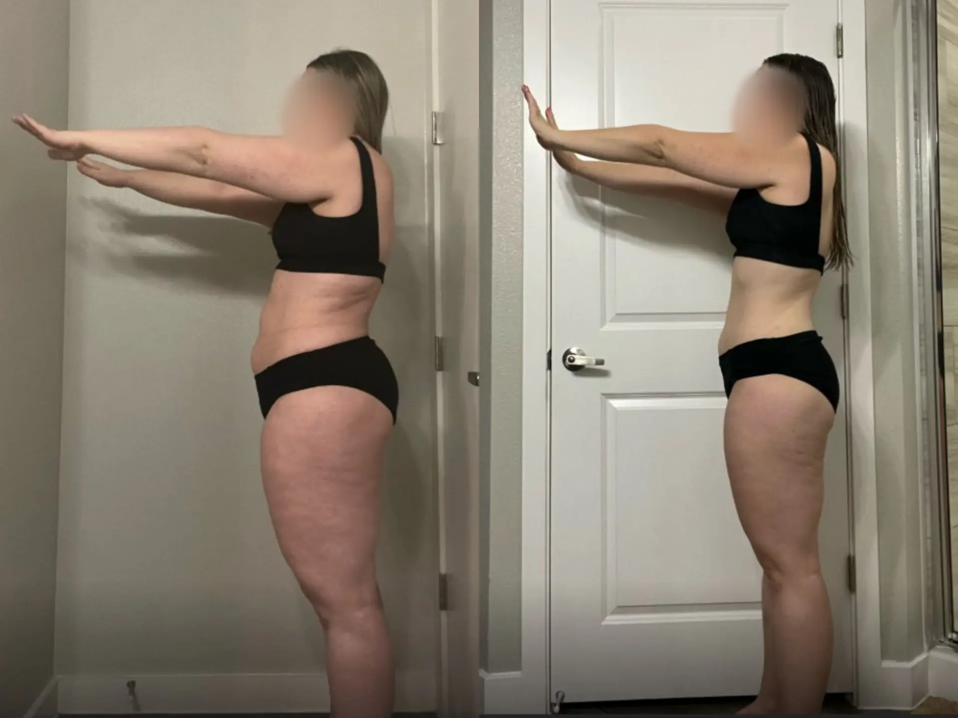 Before and after photos of Kylie C, Side, before and after