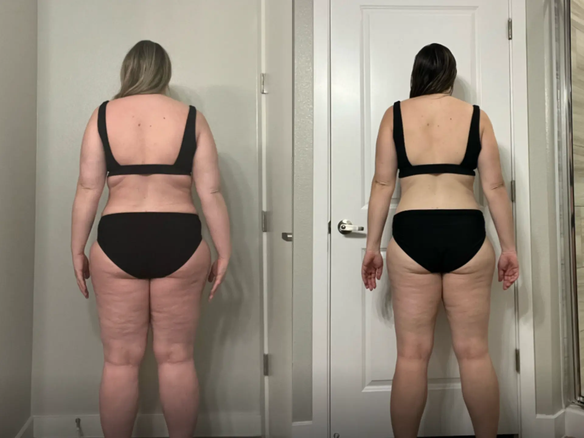 Before and after photos of Kylie C, Back, before and after
