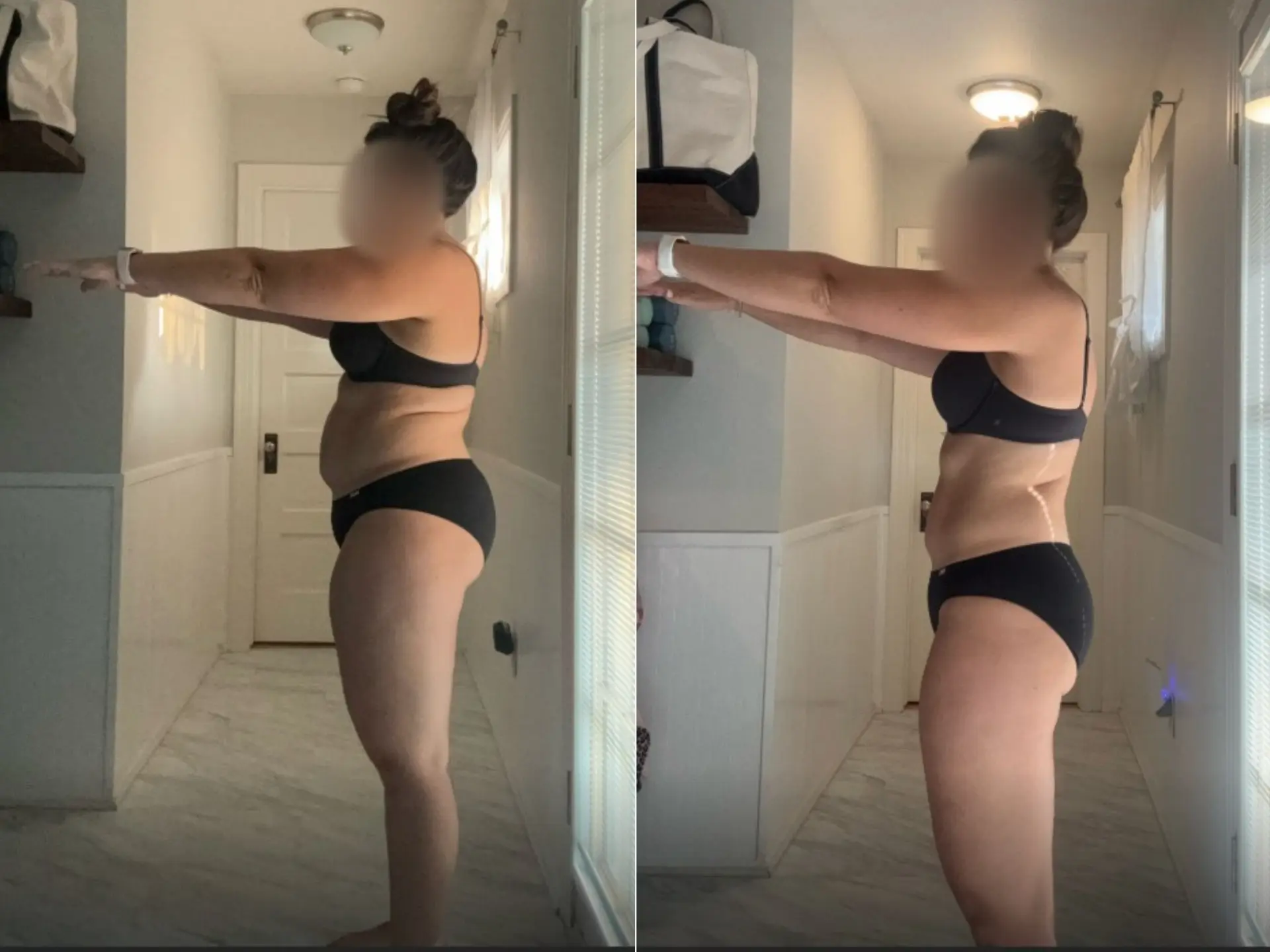 Before and after photos of Tori M, Side, before and after