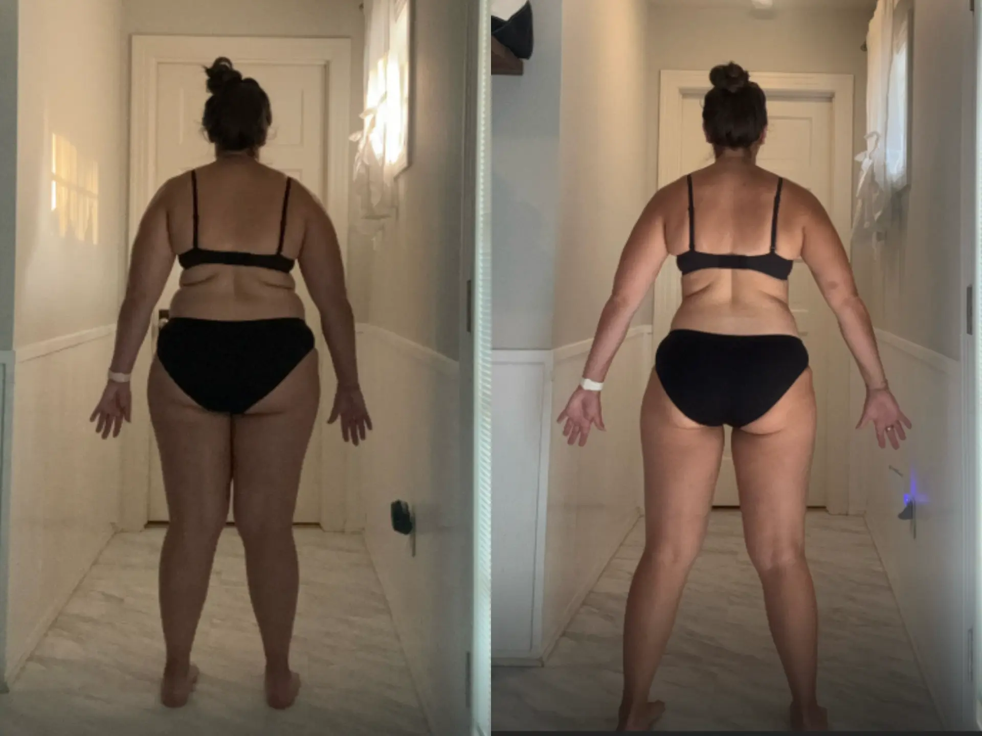 Before and after photos of Tori M, Back, before and after